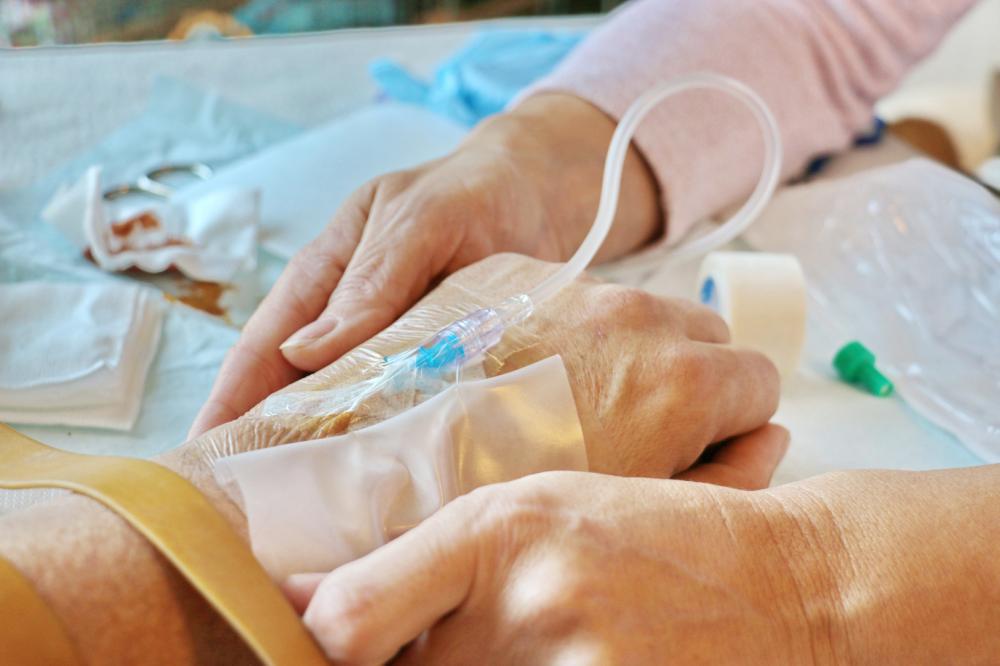 Perfusion